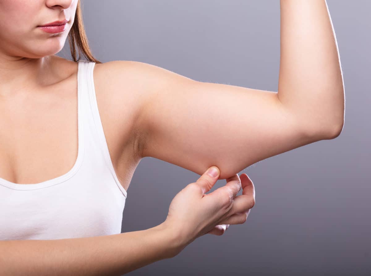 Lipödem Arme